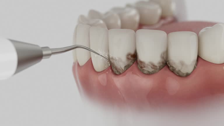 Reliable Emergency Dentist contractor in Lubbock, TX by Smile Center Dentistry